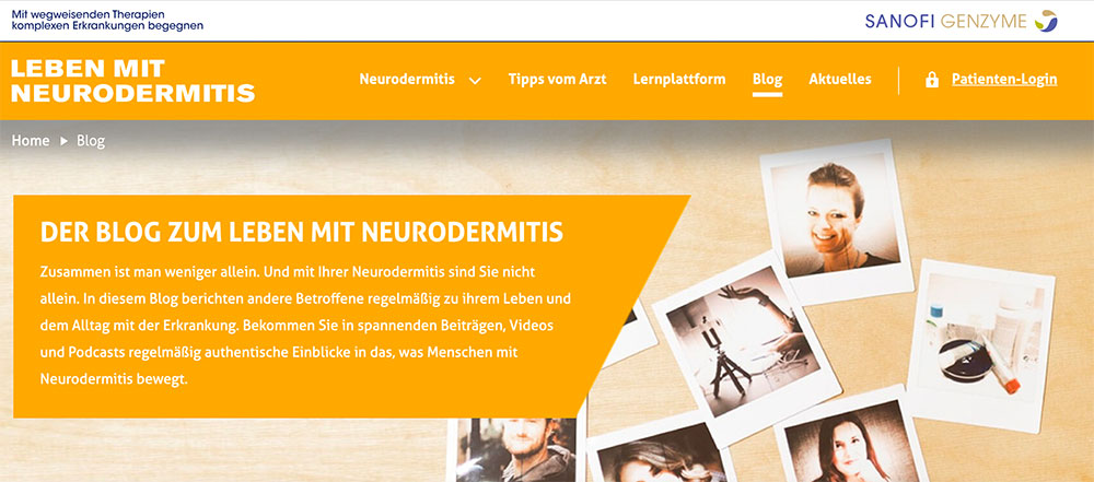 Nik stellt vor: Leben mit Neurodermitis Blog